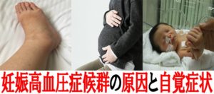 妊娠高血圧症候群になる原因と自覚症状