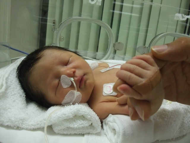 赤ちゃんの障害