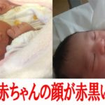 出産直後の赤黒い娘の顔色が気になったので理由を調べてみた
