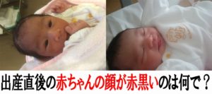 出産直後の赤黒い娘の顔色が気になったので理由を調べてみた