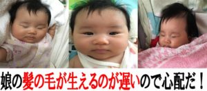 赤ちゃんの薄毛って心配しなくてもいいの?
