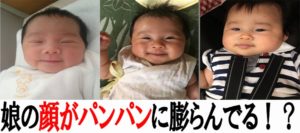 娘の顔がパンパンに膨らんでいる！赤ちゃんが太る状態を調べてみた