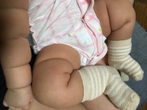 娘の腕と脚がプニプニ